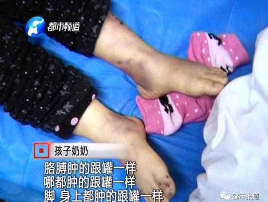 4岁女孩被亲妈虐待致死 只因...