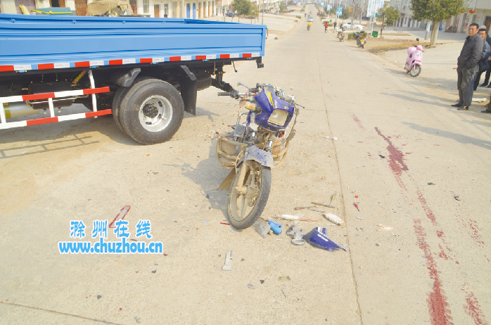 滁州在线-社会民生-男子倒车不慎，将人撞成重伤